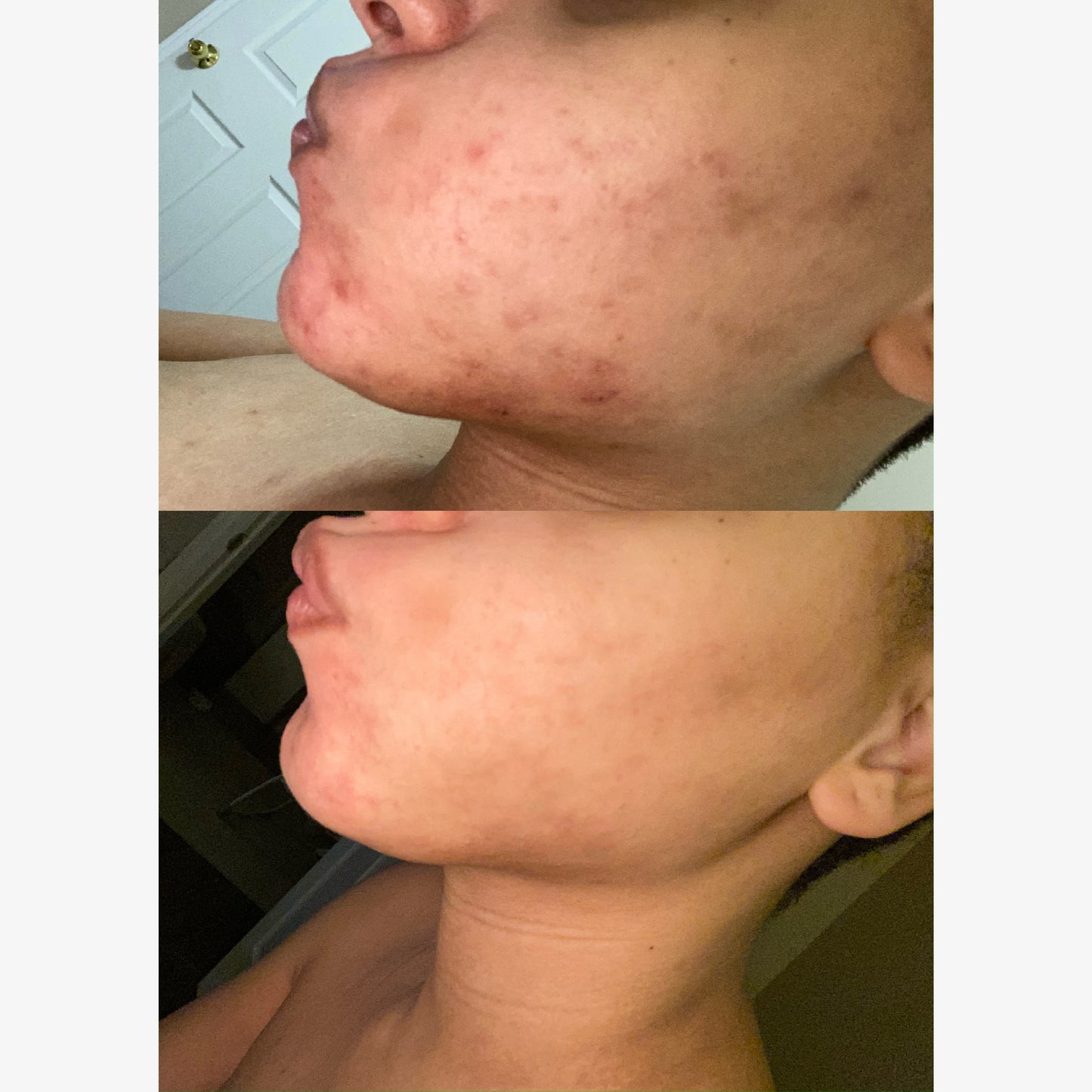 Hydrating Face Moisturizer